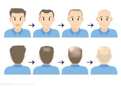 防脫育發(fā)什么牌子效果好？十大防脫生發(fā)品牌